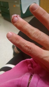 That is my missing chunk finger without the bandage. Don't tell me what it looks like...I don't want to know. Just the thought of it grosses me out. But I thought YOU guys might like to see...